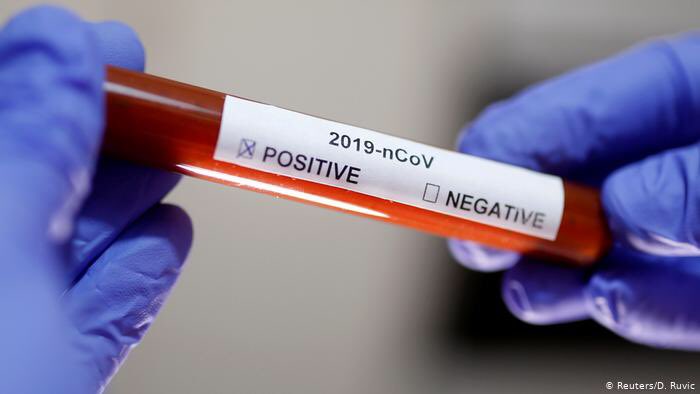 El coronavirus puede ser controlable en Chimborazo