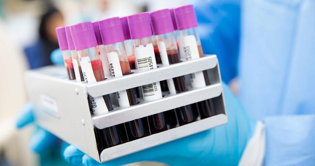 Laboratorios de la Espoch autorizados para la aplicación de pruebas PCR. http://44.213.112.5