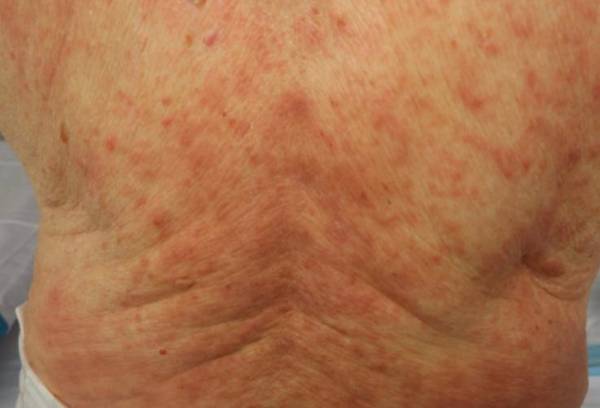 Problemas dermatológicos