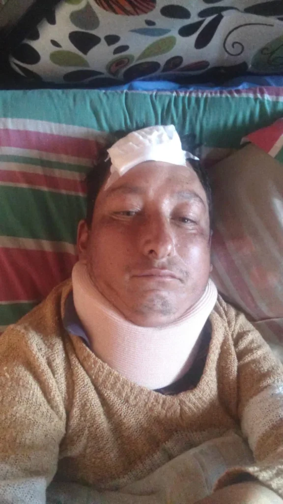 El trabajador estaría postrado luego de ser atropellado