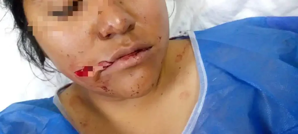Mujer recibió 9 puñaladas y sobrevivió, el agresor es su expareja