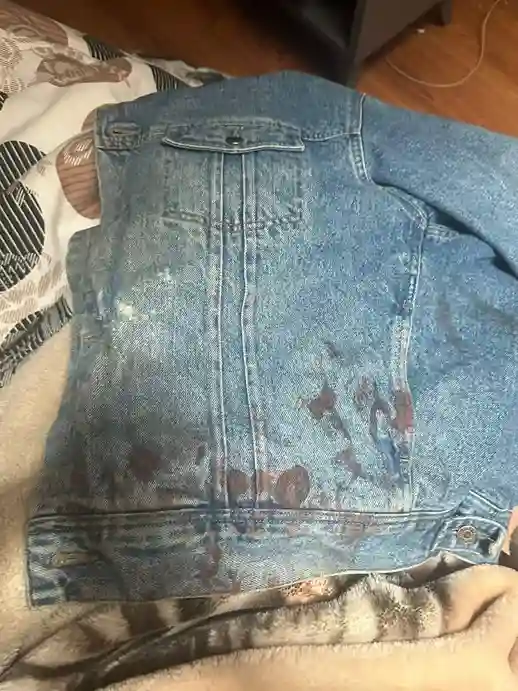 El joven baleado en Riobamba sería por ajuste de cuentas. Las investigaciones de la Fiscalía de Chimborazo continúan