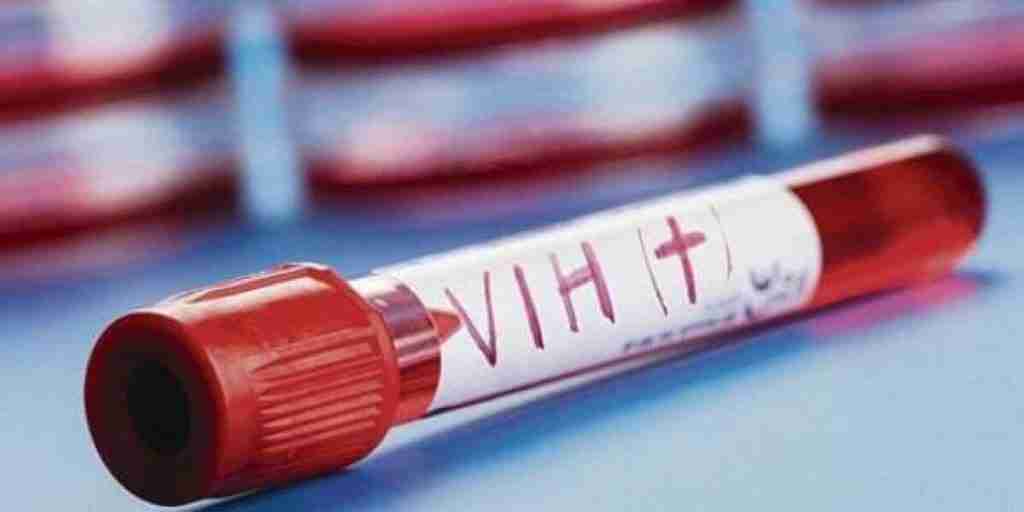 Chimborazo reporta más de 350 pacientes con VIH en tratamiento