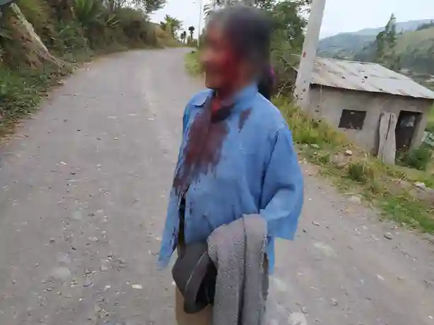 Pastora caminó ensangrentada por la antigua vía a Baños, que pasa por su propiedad, dijo Luis Alfonso