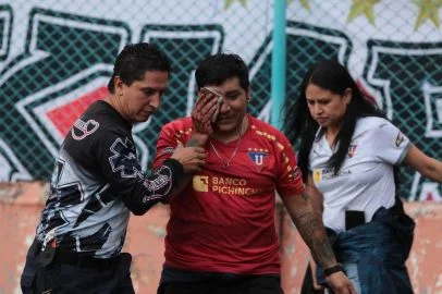 Hincha de Liga de Quito pide justicia tras perder su ojo en estadio.