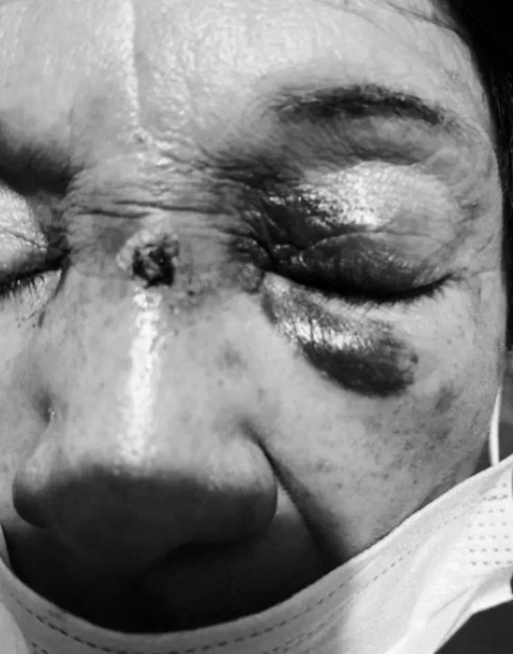 Hombre había agredido a adultos mayores luego de un accidente